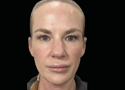 Emface_PIC_Ba-card-female-face-097_ENUS100-AFTER-Emface Emface_PIC_Ba-card-female-face-097_ENUS100-AFTER-Emface