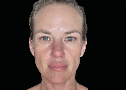 Emface_PIC_Ba-card-female-face-097_ENUS100-BEFORE-Emface Emface_PIC_Ba-card-female-face-097_ENUS100-BEFORE-Emface