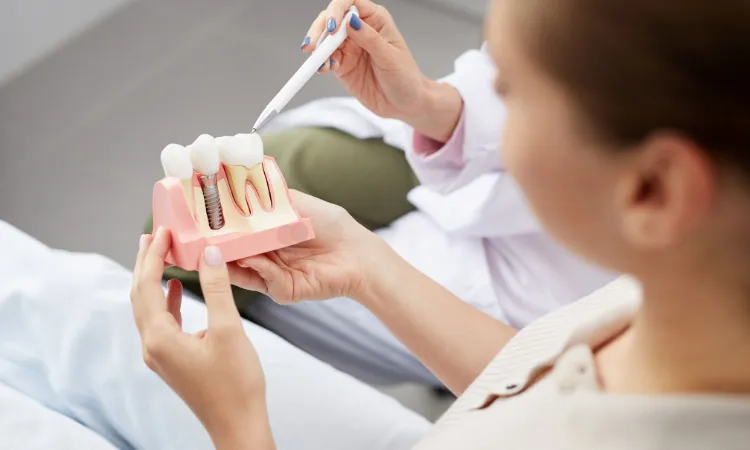 How Long Do Dental Implants Really Last? in Omaha, NE